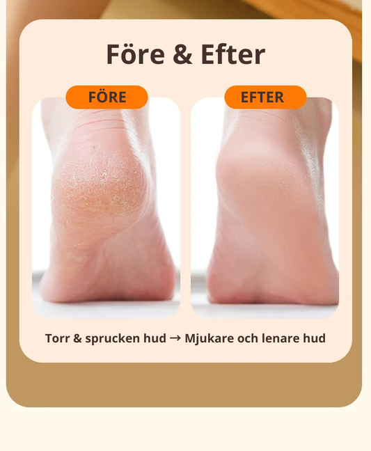 Elektrisk Fotfil med LED-ljus
